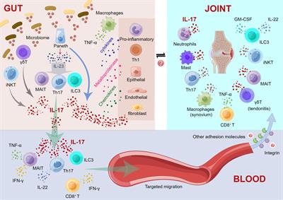 Emerging story of gut dysbiosis in spondyloarthropathy: From gastrointestinal inflammation to spondyloarthritis